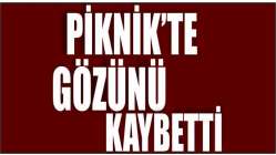 Piknik’te gözünü kaybetti